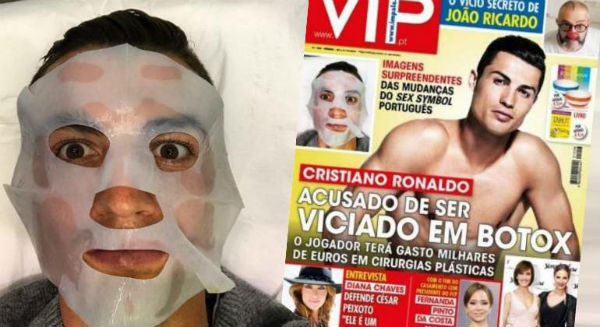 cr7-botox