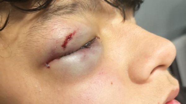 menor vallecas agresion marroquies
