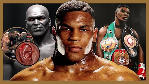 tyson